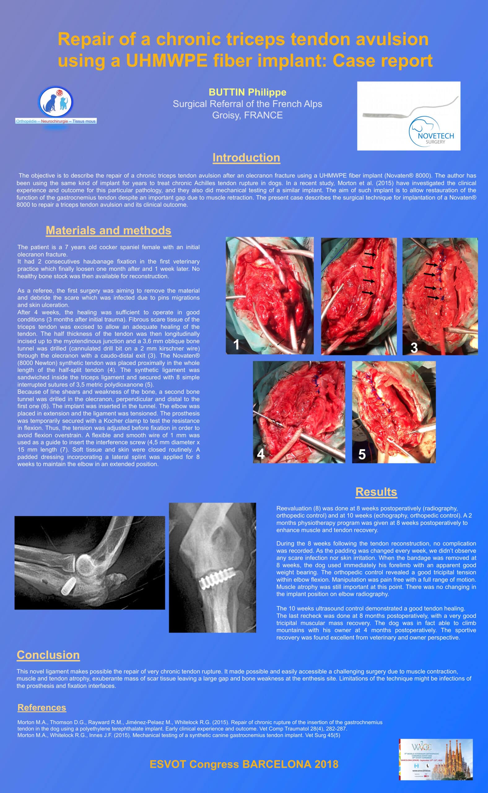 Elbow luxation stabilization